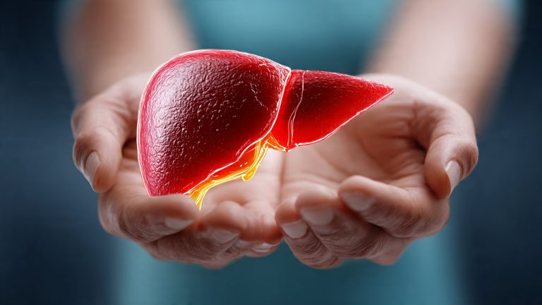 Best 5 Diets for Fatty Liver: A Comprehensive Guide to Reversing Liver Damage Naturally